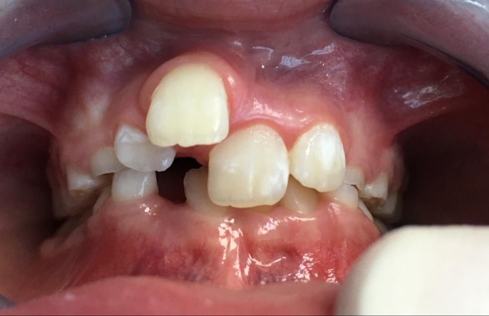 Orthodontics treatment in dubai